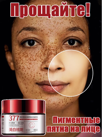 Crème visage élimination des taches