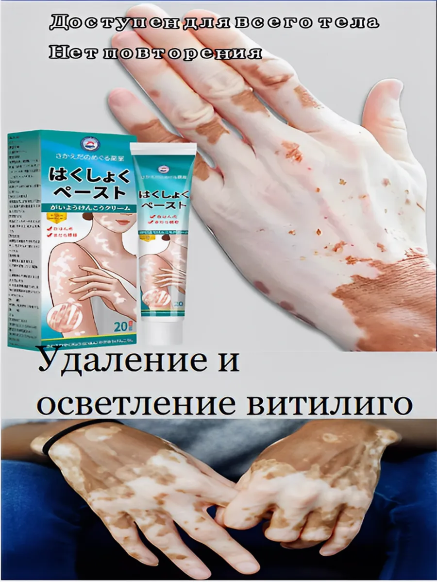 Crème contre le vitiligo et les taches blanches